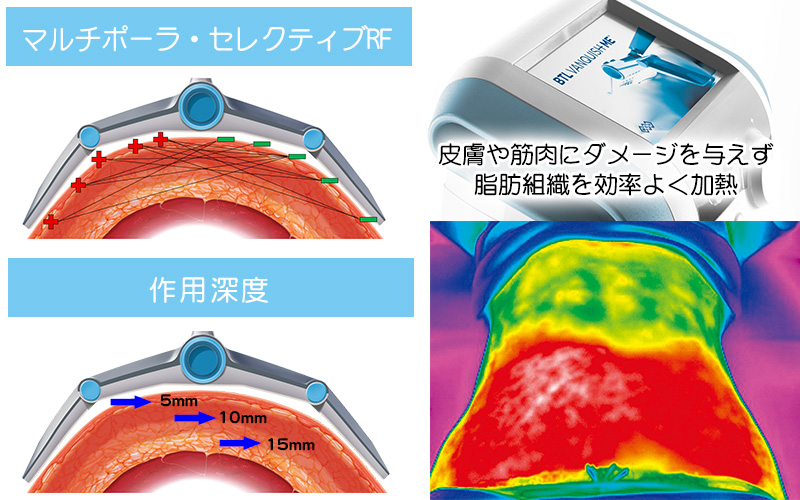 ヴァンキッシュ